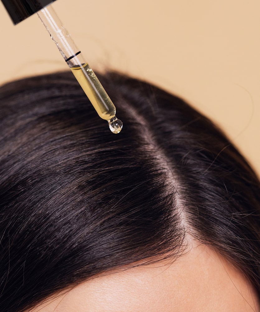 oily-scalp-and-dandruff